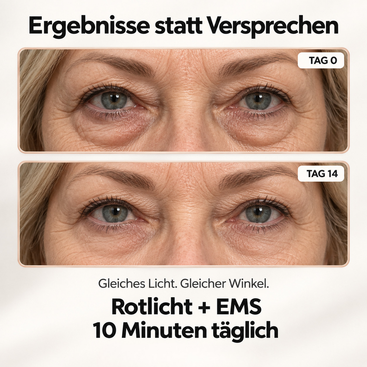 Caviraa EyeLift™ – 2-in-1 Rotlicht- & EMS-Augenpflege